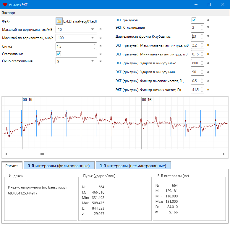 Neyrobotics Physobelt: analysis of the ECG