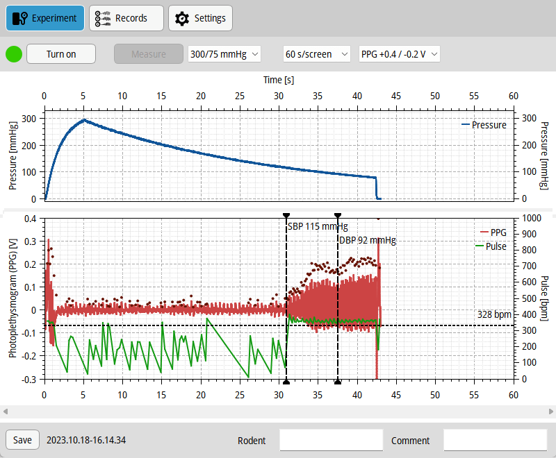 Systole: NIBP measurement